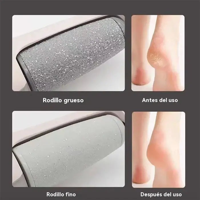 ✨Rolo elétrico para calcanhares – remove a pele áspera e alisa os pés, com 2 cabeças intercambiáveis + USB✨